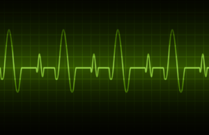 ELK Monitoring – Part 4 – Setup Filebeat and Pega log JSON objects